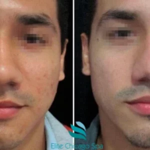 Diamond Glow Facial