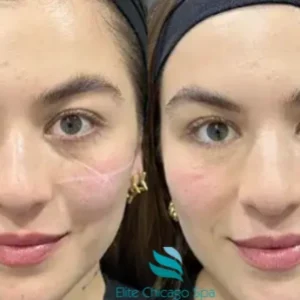 facial